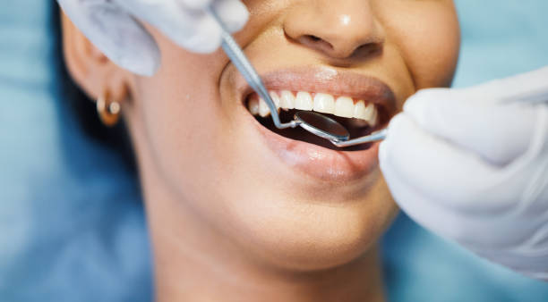 Best Broken or Chipped Tooth Repair in Belle Glade, FL