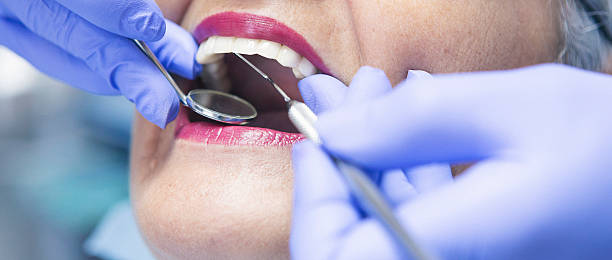 Best Emergency Care for Gum Disease in Belle Glade, FL
